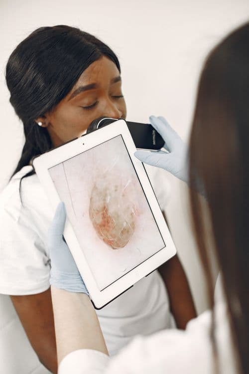 Excimer Laser